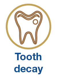 Tooth decay